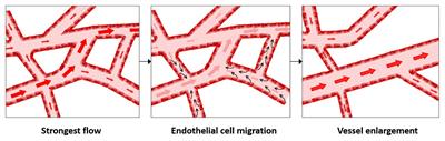 Vessel Enlargement in Development and Pathophysiology